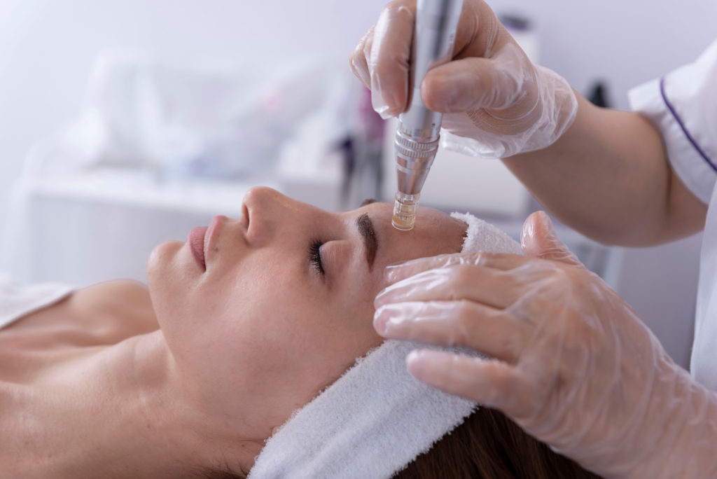 What are the Benefits of SkinPen Microneedling