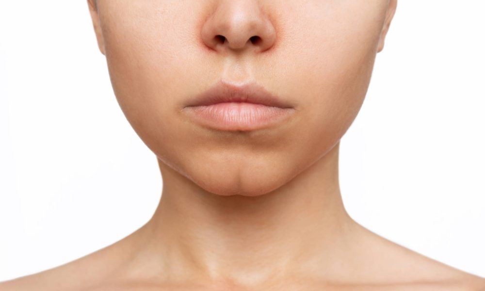 Understanding the Dimpled Chin Causes, Treatment Options, and Enhancing Your Profile