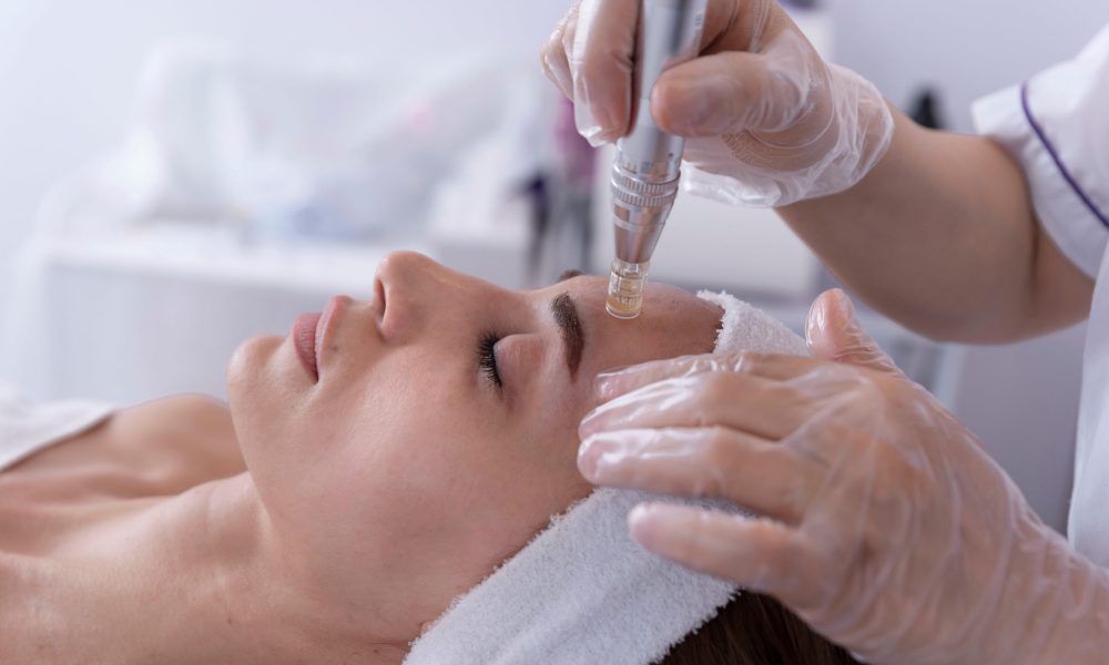 What are the Benefits of SkinPen Microneedling